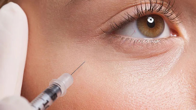 مراقبت های بعد از تزریق ژل زیر چشم