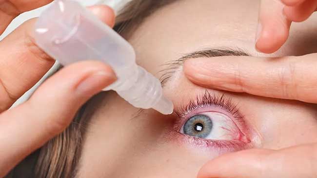 چطور از خشکی و قرمزی چشم در فصل گرما جلوگیری کنیم؟