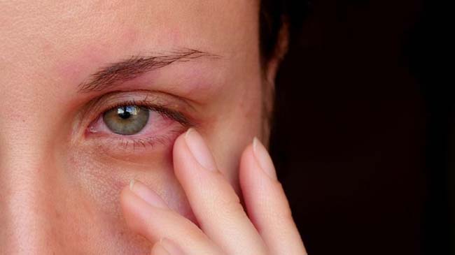دلیل خشکی چشم، هنگام استفاده از لنزهای چشم