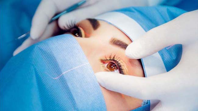 مراقبت های بعد از عمل لنز داخل چشمی